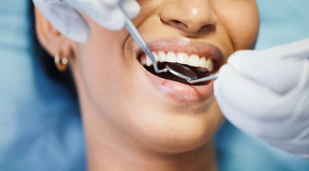 Best Emergency Dental Care for Sports Injuries in Nutter Fort, WV